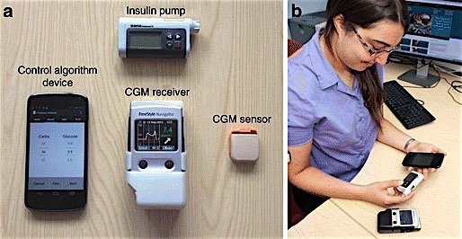 Cambridge-Universtiy-artificial-pancreas-insulin-pump-diabetes-EDIWeekly